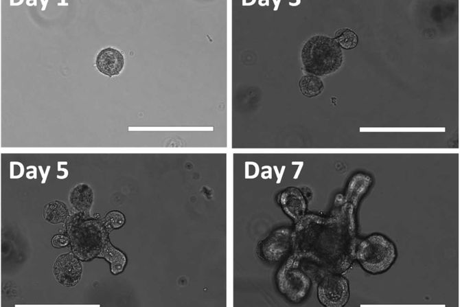 organoid