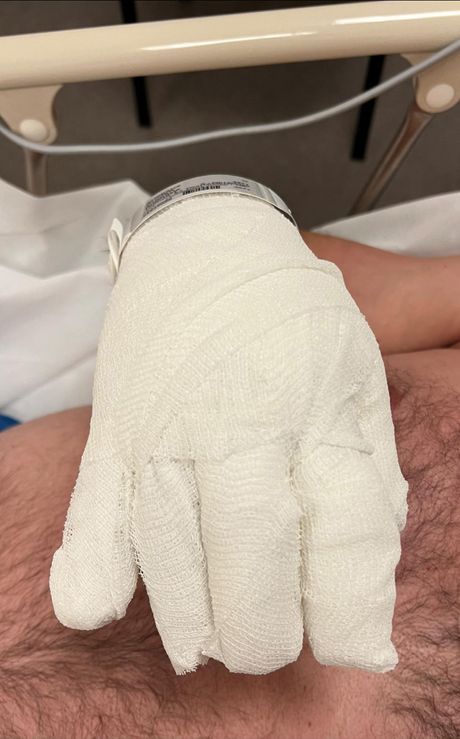 stradao gradonacelnik