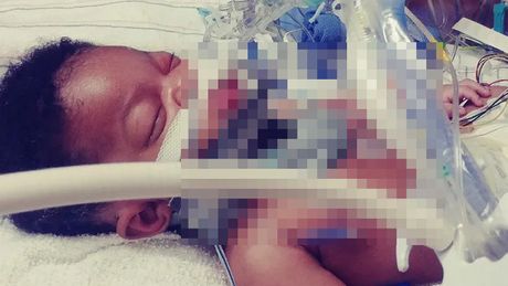 Anthony Trice,  De'Anthony Trice