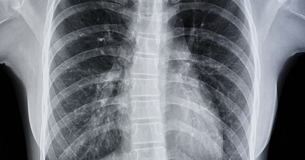 Danima je teško disao, a onda su lekari otkrili zašto: Evo šta je ...