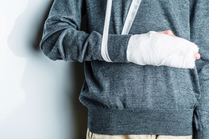 Polomljena ruka zavoj gips Polomljena ruka zavoj gips