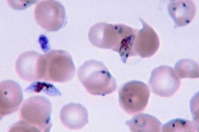 Plasmodium falciparum, malarija