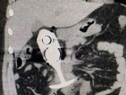 Seks igračka skener Redit Reddit