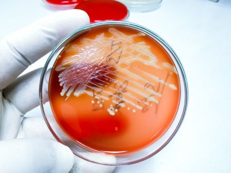 Staphylococcus stafilokokus bakterije Staphylococcus stafilokokus bakterije