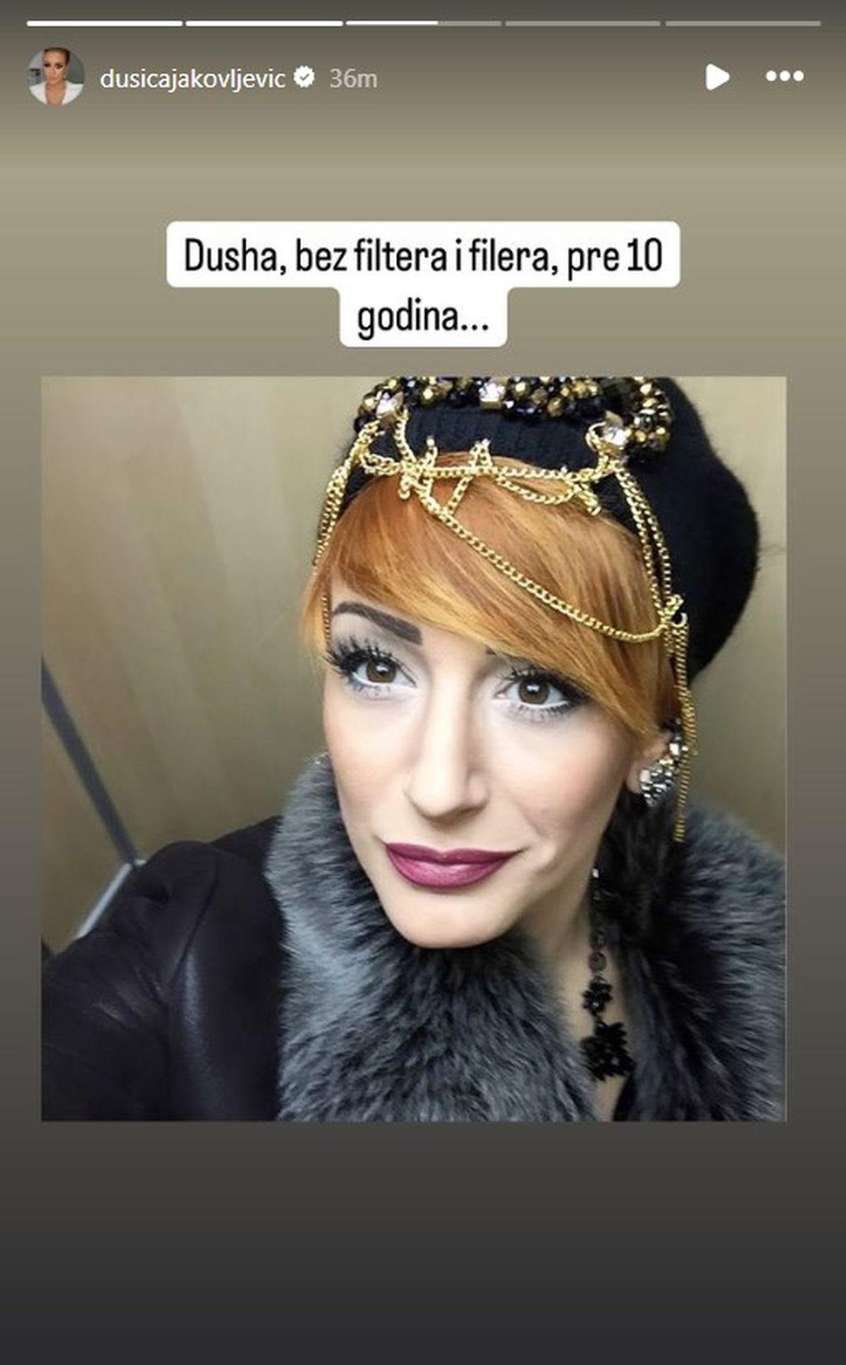 Voditeljka Pinka uradila grudi, nos, usta i zube - sada pozirala samo u peškiriću! Svi vide još jednu promenu