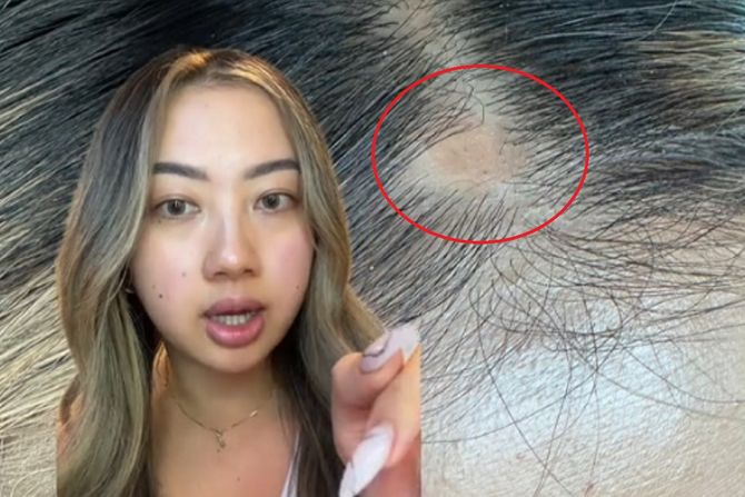 Hillary Guyen Hillary Guyen