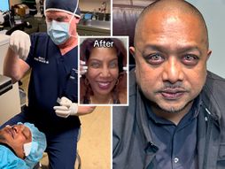 Dr Brian Boxer Wachler, promena boje očiju