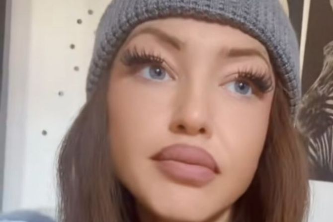 Devojka koja je doživela neprijatnost u GSP Devojka koja je doživela neprijatnost u GSP