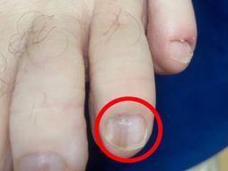 Kelly i muž David Edges, nokat rak