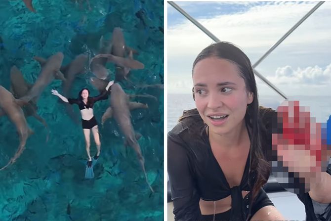 napad ajkule napad ajkule