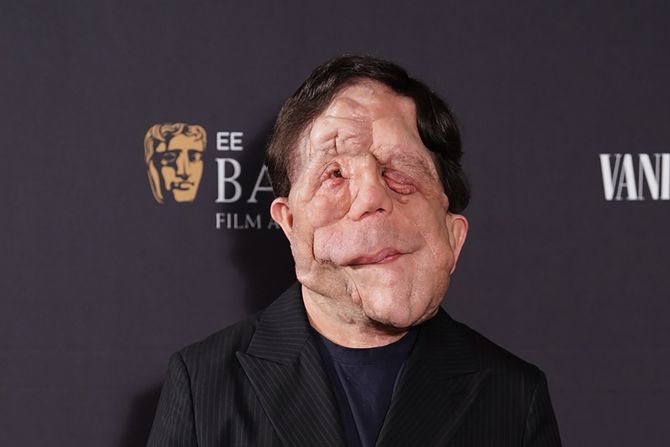 Adam Pearson Adam Pearson