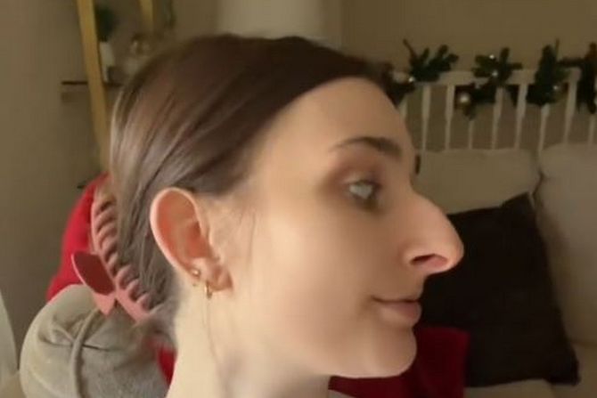 Devyn Aiken, nos Devyn Aiken, nos