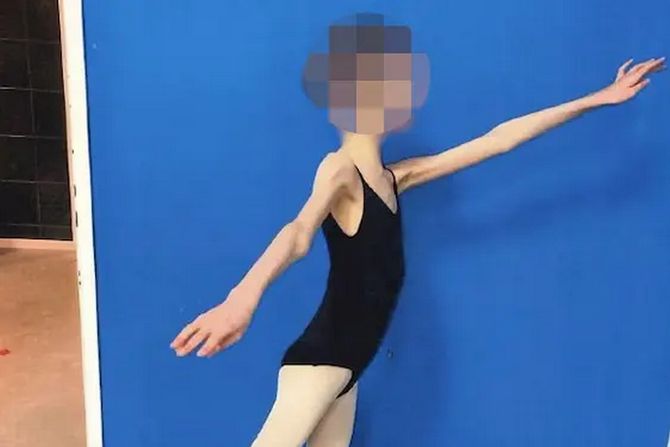 Devojčica balerina Kate Devojčica balerina Kate