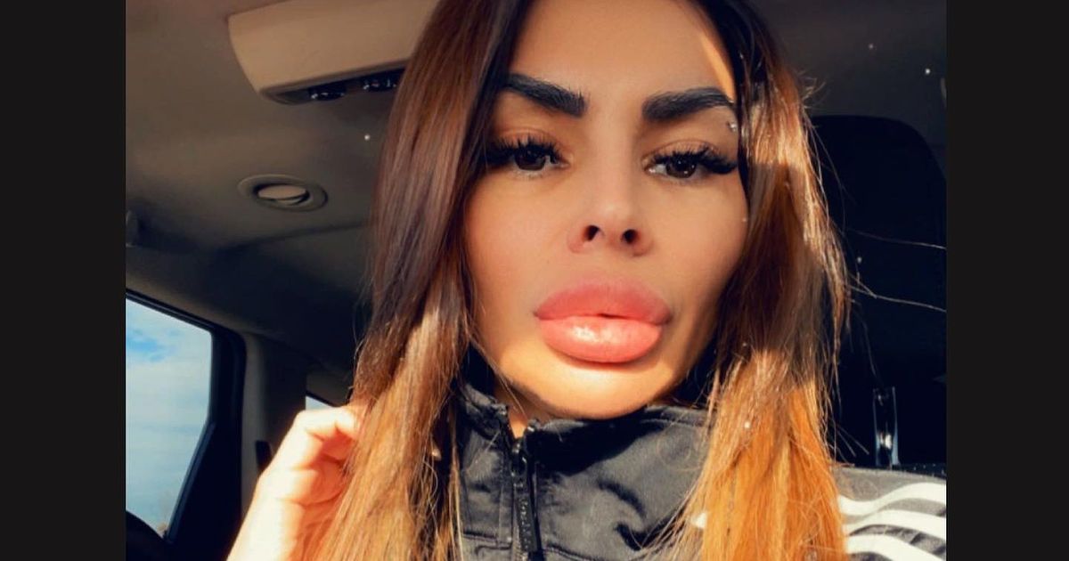 Jovanu partner ostavio u visokorizičnoj trudnoći, ona otkrila kroz šta prolazi 