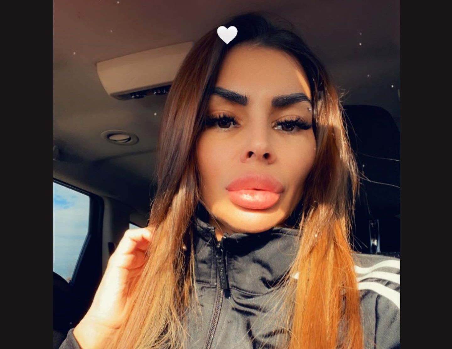 Jovanu partner ostavio u visokorizičnoj trudnoći, ona otkrila kroz šta prolazi "Dobijam jake injekcije..."