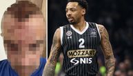 Uznemirujuće! Ovako izgleda momak kome je Karlik Džons slomio flašu o glavu: Lice mu je unakaženo