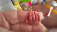 Rodila se beba čudo! Ima samo 820 grama, mama Sara ponosna na svog malog borca