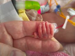 Beba Kloi se rodila sa 820 grama