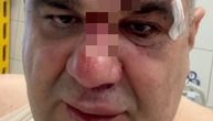 Operisan Saša Mirković: Evo u kakvom je stanju