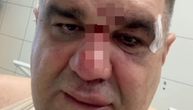 Saša Mirković se oglasio iz bolnice nakon incidenta u Zagrebu: Evo kakve povrede je zadobio
