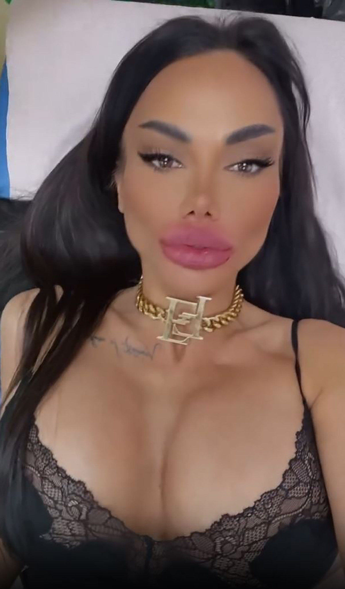 Starleta nezasita estetskim operacijama: Tamara posle mnoštvo njih ponovo na "remontu", evo šta je sad menjala