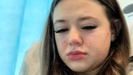 Zbog jedne greške devojka (22) je ostala prikovana za krevet: "Jedva su mi spasili noge, mami sam obećala ovo"