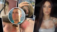 Presuđeno Damjanu koji je brutalno pretukao suprugu, sestru Uki Q! Ovoliku kaznu zatvora je dobio!