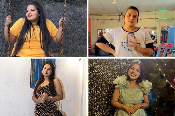 gojaznost, pre, posle gojaznost, pre, posle