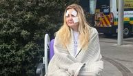 Ona je HODAJUĆA MISTERIJA MEDICINE: Telo poput slagalice, 20 godina se bori za normalan život