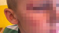 Oglasila se direktorka šabačke škole u kojoj je povređen prvak: Sa leđa ga na stepenicama gurnuo stariji đak