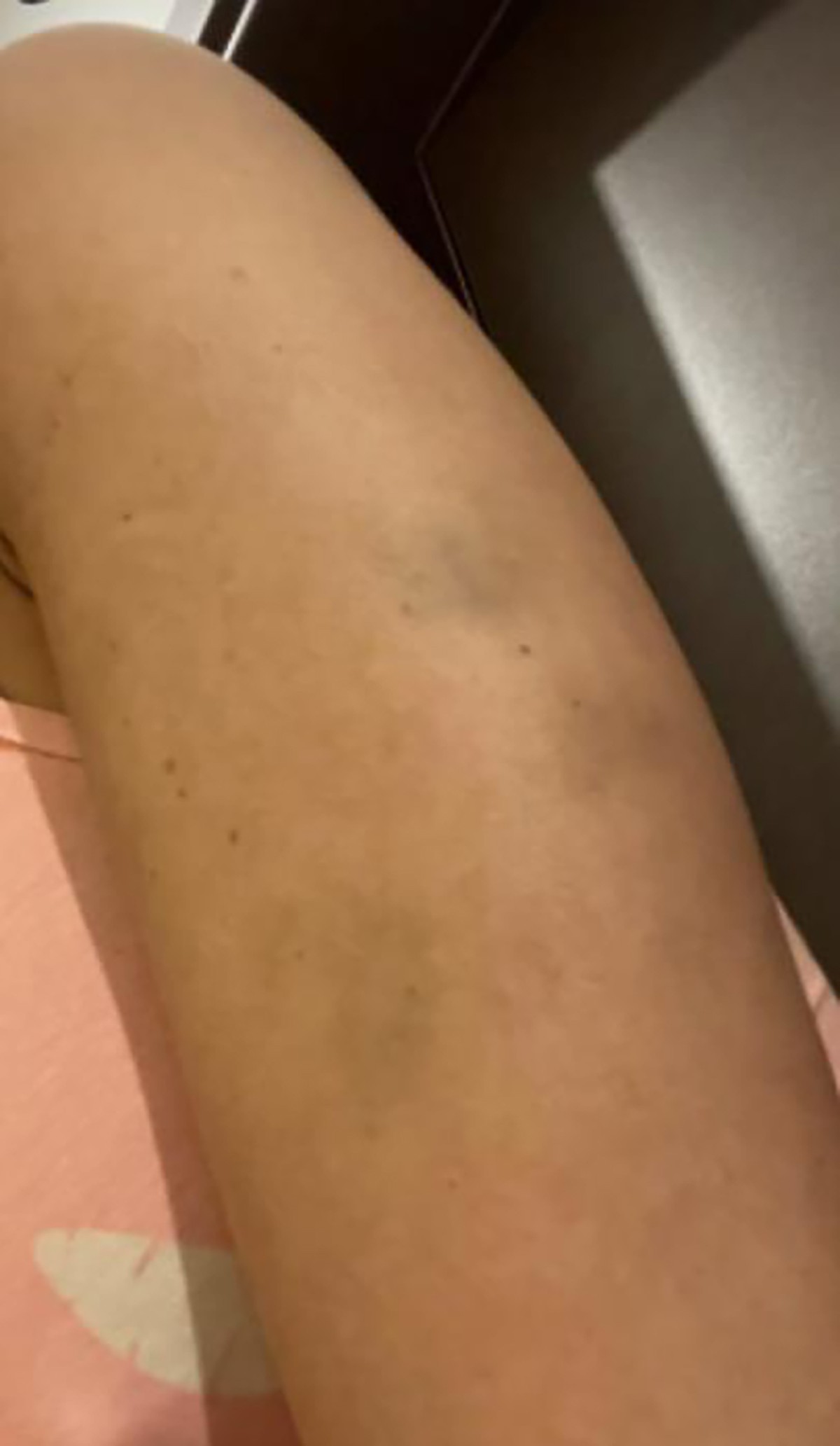"Objavila sam samo mali deo!" Maja Marinković se prvi put oglasila nakon što je optužila Cara za nasilje