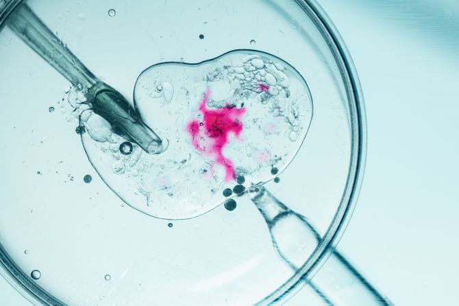 IVF vantelesna oplodnja