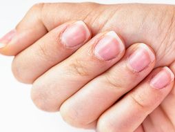 Zanoktice, nega noktiju