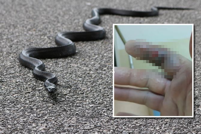 čoveka ujela zmija čoveka ujela zmija