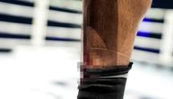 UZNEMIRUJUĆE! Jeziva povreda Sadika, ovako nešto se ne pamti, publika nemo posmatrala