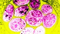 Ovaj parazit koji se lako prenosi ODSECA GLAVU ljudskim spermatozoidima!