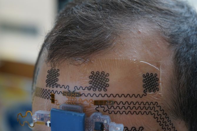 Električna tetovaža na licu