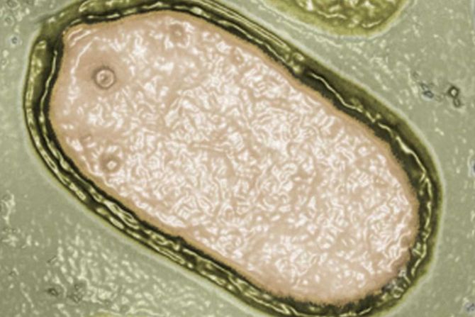 pandoravirus, džinovski virus pandoravirus, džinovski virus