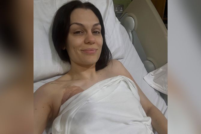 Jessie J