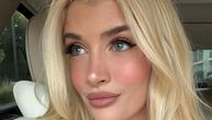 Ćerka Čarlija Šina je Onlifans model, sad mora da se ODREKNE SILIKONA: Kosa joj OPADA, na sve je alergična