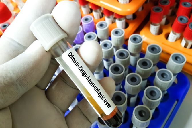 Crimean Congo haemorrhagic groznica virus test Crimean Congo haemorrhagic groznica virus test