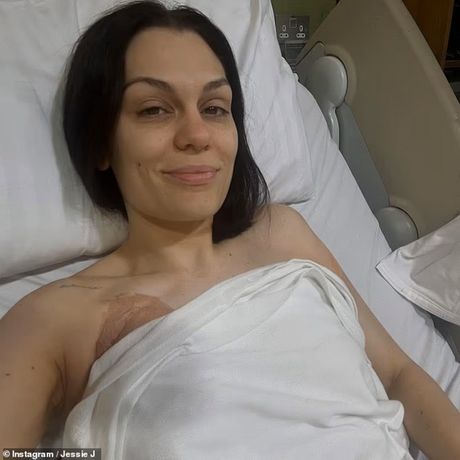 Jessie J Jessie J