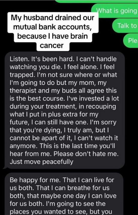 Žena tumor na mozgu Žena tumor na mozgu