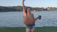 Grudi su joj teške VIŠE OD 13 KILOGRAMA, zbog njih ima invalidska kolica: I dalje rastu, život joj je borba