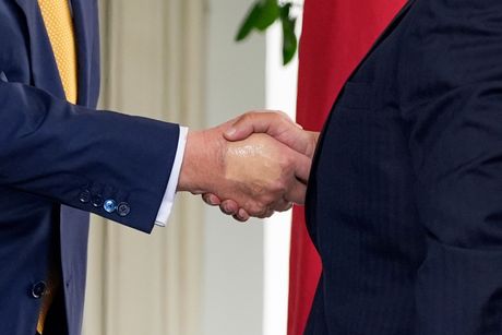 Donald Tramp ruka Donald Tramp ruka