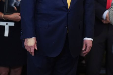 Donald Tramp ruka Donald Tramp ruka