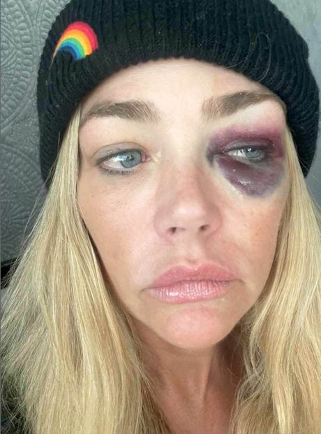 Denise Richards Denise Richards