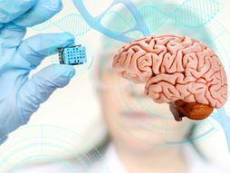 Čip u mozak