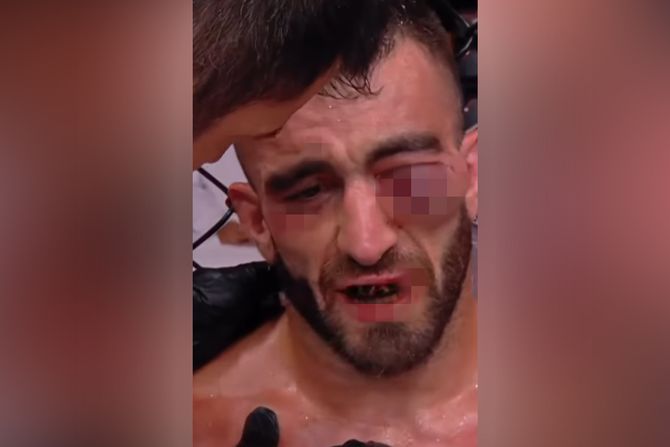 Ufc