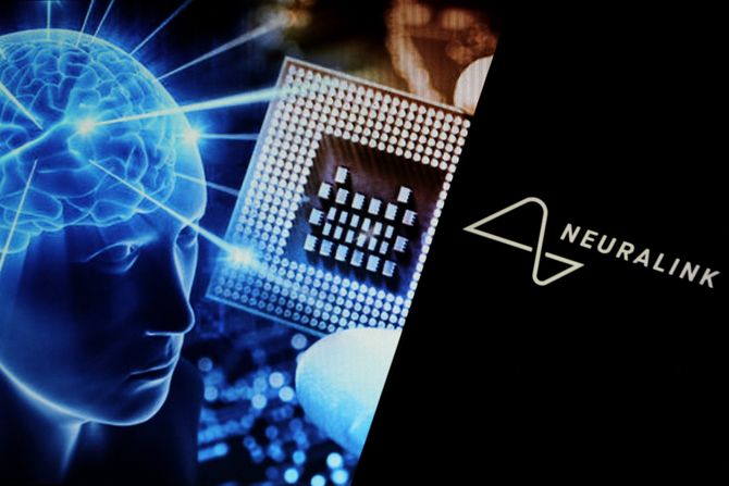 Neuralink Neuralink